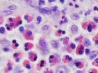 Eosinofiele granulocyten in biopt