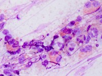 Dip quick, diff quick kleuring