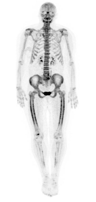 Marie-Bamberger PET-CT-scan
