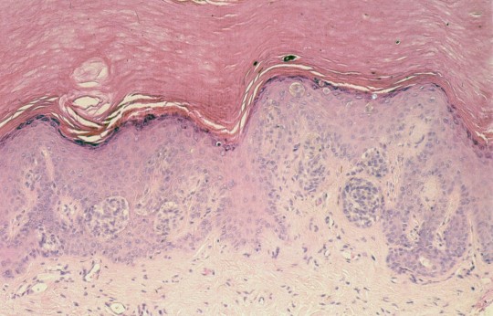 The skin under the microscope