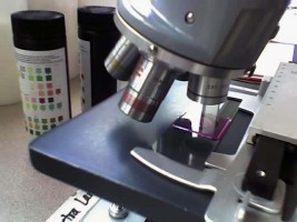 Editing a skin biopsy - in alcohol