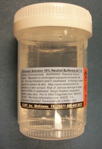 Editing a skin biopsy - in formalin