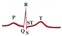 ST-segment