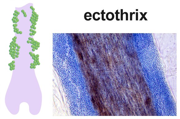 ectothrix