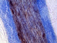 Endothrix groeiwijze schimmel