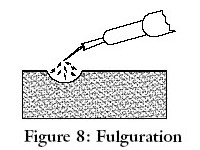 Electro-dessicatie en fulguratie