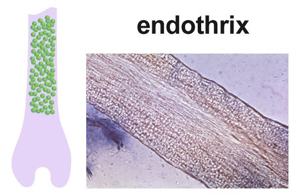 endothrix