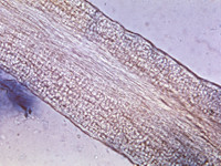 Endothrix groeiwijze schimmel