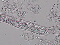 Endothrix growth habit fungus