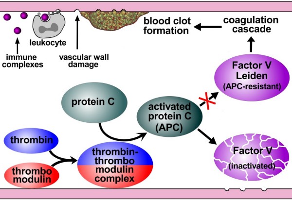 Factor V Leiden