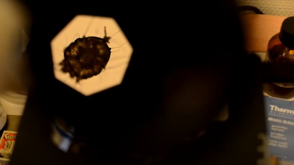 Scabies mite crawling under the microscope