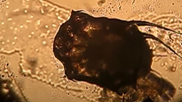 Schurftmijt rondkruipend onder de microscoop