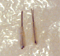 de follikels worden gescheiden en allemaal apart in een klein sneetje in de hoofdhuid geplaatst