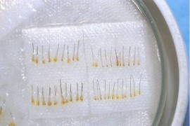 geoogste haren, vrijgeprepareerd onder de microscoop uit een reep huid afgenomen van het achterhoofd