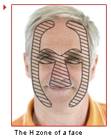 H-zone