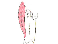 Meralgia paresthetica