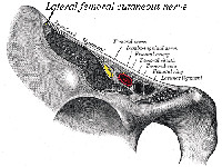 Meralgia paresthetica
