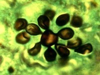 Paracoccidioides brasiliensis