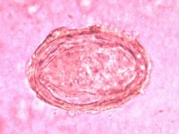 Schistozoma mansoni ei