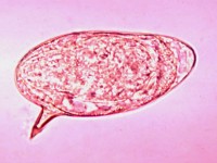 Schistozoma mansoni ei