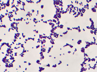 Stafylococcus aureus