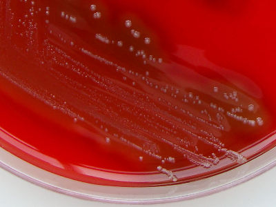 Streptococcus pyogenes