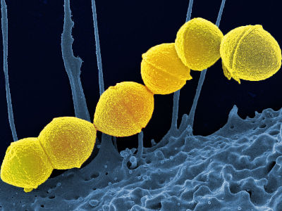 Streptococcus pyogenes