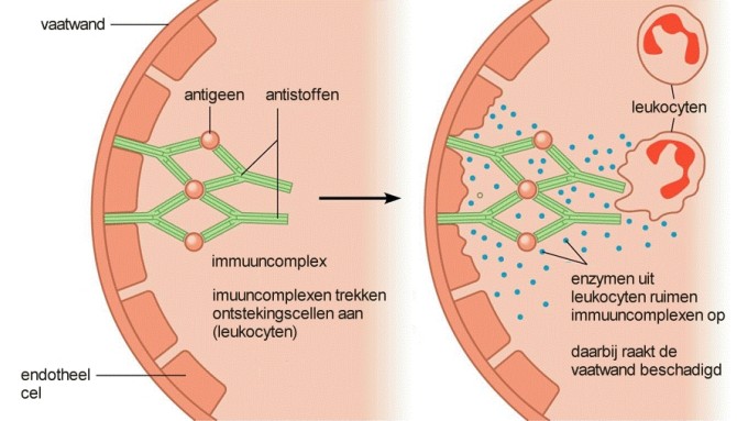 Type III immune response with circulating immune complexes
