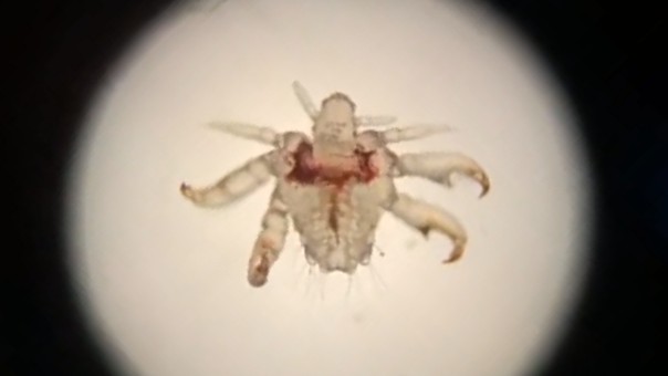 Video bewegende schaamluis onder de microscoop (met dank aan C.L.M. van Hees)