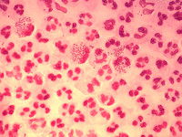 Fluor vaginalis diagnostiek