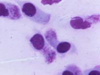 Fluor vaginalis diagnostiek