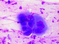 Fluor vaginalis diagnostiek