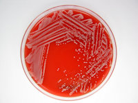 Staphylococcus lugdunensis