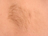 Glad spiercel hamartoom