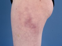 Horse riders perniones