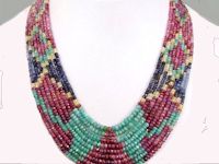 Juxtaclavicular beaded lines