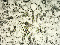 Langerhans cell