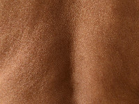 Mid-dermale elastolyse