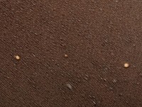 Milia-like (idiopathic) calcinosis cutis