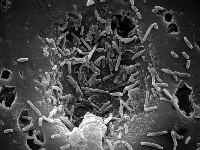Mycobacterium chelonae
