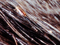 Head lice, pediculosis capitis
