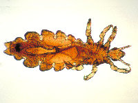 Head lice, pediculosis capitis