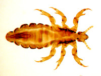 Head lice, pediculosis capitis