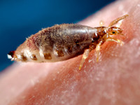 Pediculus humanus corporis