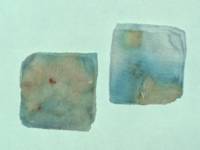 Groen verkleurde gazen door Pseudomonas