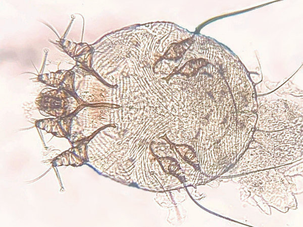 Schurftmijt onder de microscoop