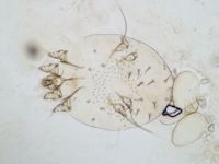 Scabies mites in the KOH preparation