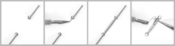 Deroofing bij hidradenitis suppurativa