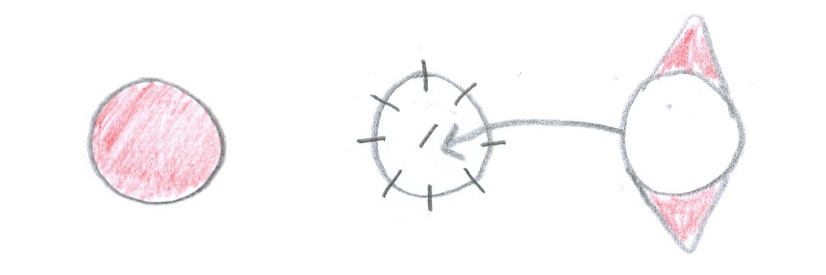 Full thickness graft