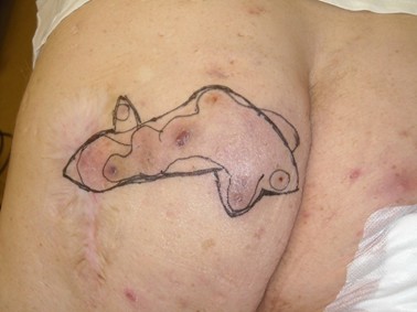 Dubbele katrolhechting